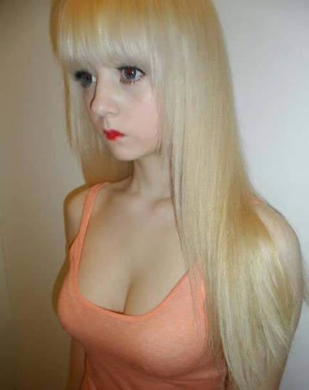 白化病能活多久：得了白化病能活多久？