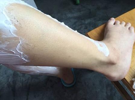 体毛去除的方法有哪些,体毛去除的方法,体毛旺盛怎么办 体毛去除的方法有哪些,体毛去除的方法,体毛旺盛怎么办