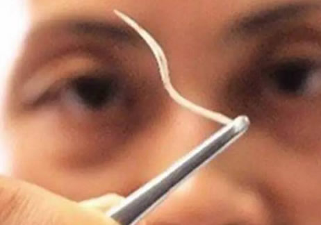 鱼刺卡在喉咙怎么办：神奇简单又灵验的方法介绍