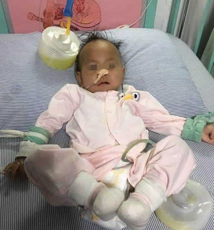 13个月宝宝胃撑破,只因喝了一碗这个(图) 13个月宝宝胃撑破,只因喝了一碗这个(图)