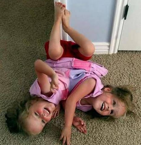 罕见全球最奇特的连体人，全球最奇特的人图片