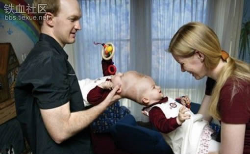 罕见全球最奇特的连体人，全球最奇特的人图片