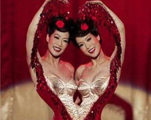 罕见全球最奇特的连体人，全球最奇特的人图片