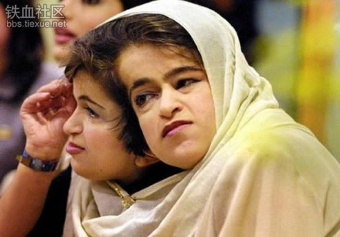 罕见全球最奇特的连体人，全球最奇特的人图片