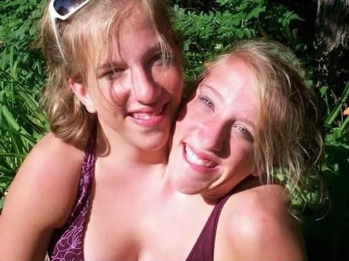 罕见全球最奇特的连体人，全球最奇特的人图片