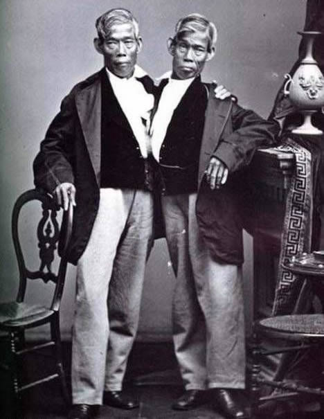 罕见全球最奇特的连体人，全球最奇特的人图片