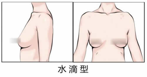 水滴型乳房:水滴胸型要如何选择文胸(图) 水滴型乳房:水滴胸型要如何选择文胸(图)