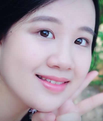 戴美瞳眼角膜成这样:长期戴美瞳的危害,戴美瞳注意事项 戴美瞳眼角膜成这样:长期戴美瞳的危害,戴美瞳注意事项