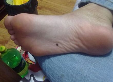 女人10处有痣是富贵命：富贵有标志看看你有几个富贵痣