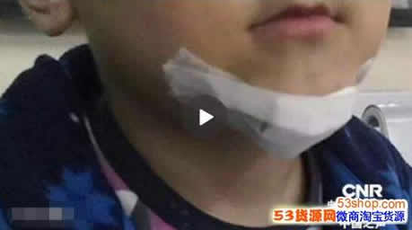 模仿抖音弄伤弟弟:模仿了什么怎么回事,抖音应该背锅吗 模仿抖音弄伤弟弟:模仿了什么怎么回事,抖音应该背锅吗