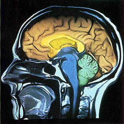 人类大脑十大未解之谜：关于人类的大脑其实很可怕