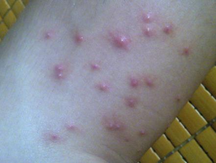 蚊子最怕这碗水!放房间一个蚊子都不敢进（图）