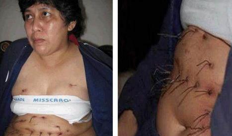 男孩一学习就流鼻血：一天多达20次,盘点世界奇葩怪病