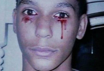 男孩一学习就流鼻血：一天多达20次,盘点世界奇葩怪病