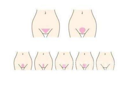 什么是维纳斯之丘：维纳斯之丘在哪里,维纳斯丘图片