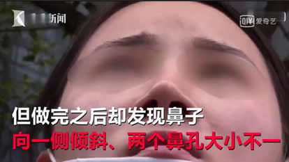 美女整鼻越整越歪：维权之路艰难,签了告知书不负责效果