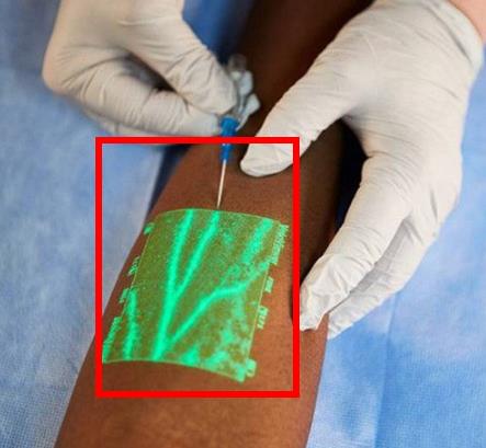 这个一扎就准的外国输液神器,中国该引进了(图) 这个一扎就准的外国输液神器,中国该引进了(图)