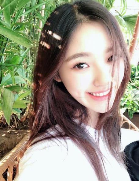 林允瘦身后腿部淤青：经历了什么,青一块紫一块大片淤青