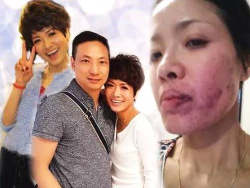 女星往脸上涂胶水：拍戏涂抹胶水,妹子涂了100层胶水