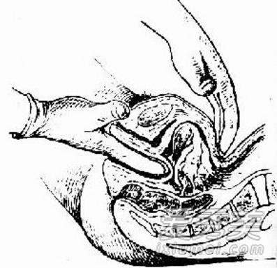 女性检查：女性阴道全套检查全过程揭晓（图）