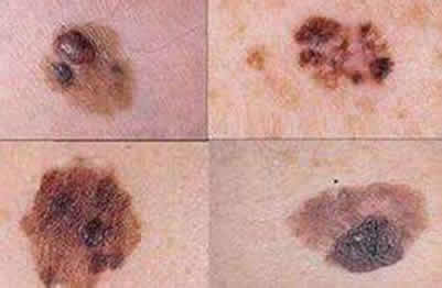 女子频繁做这件事癌症率会翻倍(图) 女子频繁做这件事癌症率会翻倍(图)