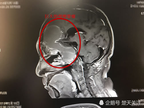 老汉长了张女人脸:苦不堪言,52年来他男生女相 老汉长了张女人脸:苦不堪言,52年来他男生女相
