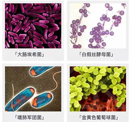 空调不洗有细菌:空调散热片的肮脏程度远大于马桶 空调不洗有细菌:空调散热片的肮脏程度远大于马桶