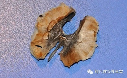 吃了那么长时间的核桃：竟不知核桃分心木的功效