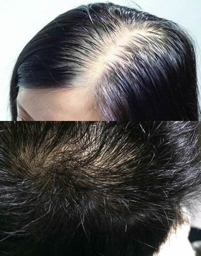 几天洗次头最健康?竟一直做错了(图) 几天洗次头最健康?竟一直做错了(图)