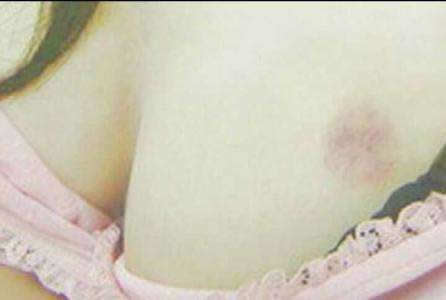 给男朋友种草莓的技巧:男人和女人爱的痕迹(图) 给男朋友种草莓的技巧:男人和女人爱的痕迹(图)