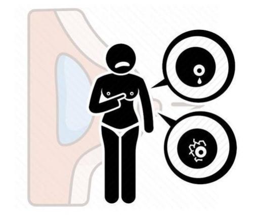 睡前小按摩护胸部(胸部按摩操作方法) 睡前小按摩护胸部(胸部按摩操作方法)