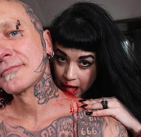 女子吃这物20年胃里取出6斤毛球:异食癖患者盘点 女子吃这物20年胃里取出6斤毛球:异食癖患者盘点