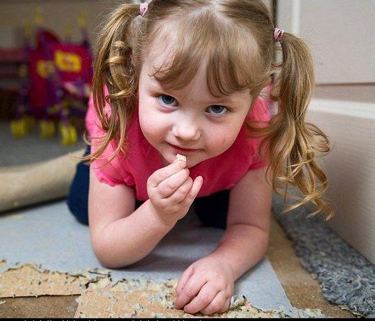 女子吃这物20年胃里取出6斤毛球:异食癖患者盘点 女子吃这物20年胃里取出6斤毛球:异食癖患者盘点