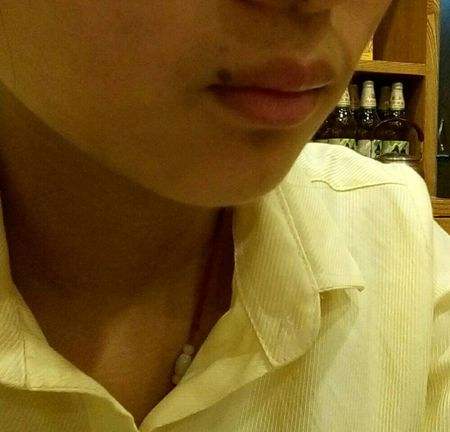 身上最好的16痣相：女人痣相说法（图）