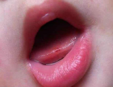 吃饭时咬到嘴和舌头可不是小事,真相很严重（图）