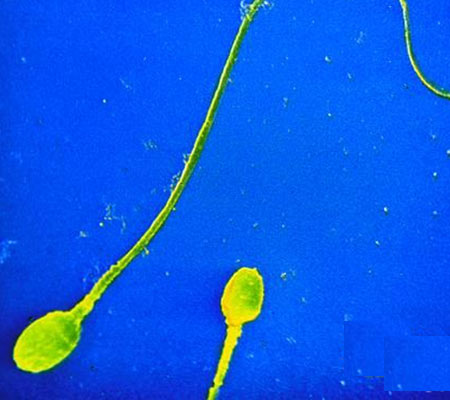 揭晓男人一生有多少精子:男人的精子会用完吗(图) 揭晓男人一生有多少精子:男人的精子会用完吗(图)