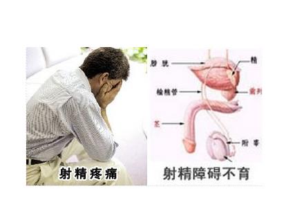 射精疼痛怎么回事:射精疼痛的原因及治疗方法 射精疼痛怎么回事:射精疼痛的原因及治疗方法