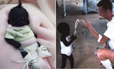 最黑的小孩：比煤炭还黑父母却以黑为荣（图）