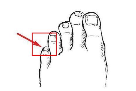 独特的基因遗传密码:脚上具备这个特征,说明你是纯种汉人 独特的基因遗传密码:脚上具备这个特征,说明你是纯种汉人