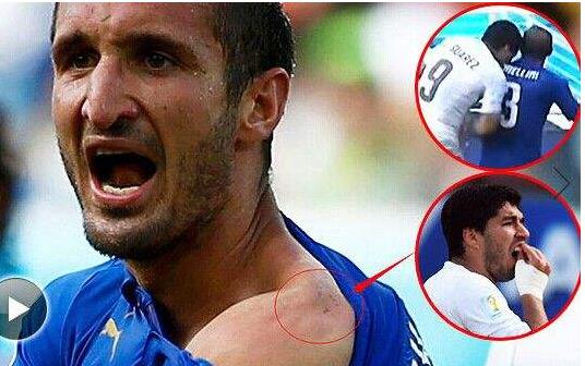 苏亚雷斯咬人：苏亚雷这样的咬人事件有几次