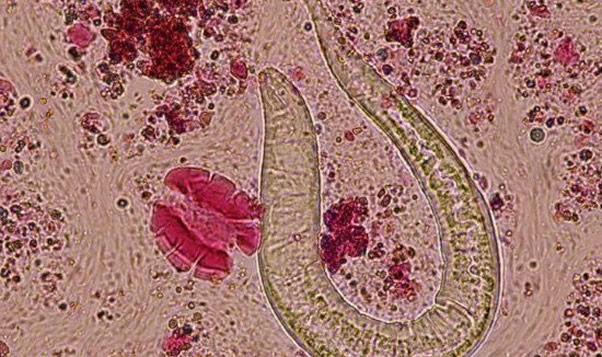 玉米男孩原型是谁 玉米男孩图片及案例描述 玉米男孩原型是谁 玉米男孩图片及案例描述