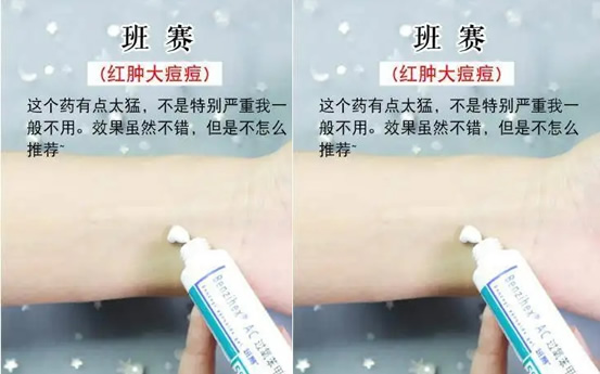 班赛有什么用 可以单独使用吗