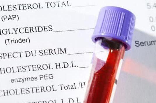 甘油三酯高是什么原因 男性甘油三酯高的原因汇总