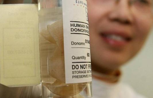 甘油三酯高是什么原因 男性甘油三酯高的原因汇总