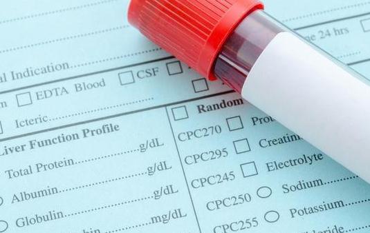 甘油三酯高是什么原因 男性甘油三酯高的原因汇总