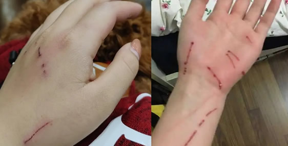 被猫抓了怎么判断没事 不小心被猫爪了该怎么办 被猫抓了怎么判断没事 不小心被猫爪了该怎么办