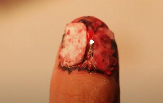 儿童画伤口吓人(小学生开始流行画伤疤的心理)