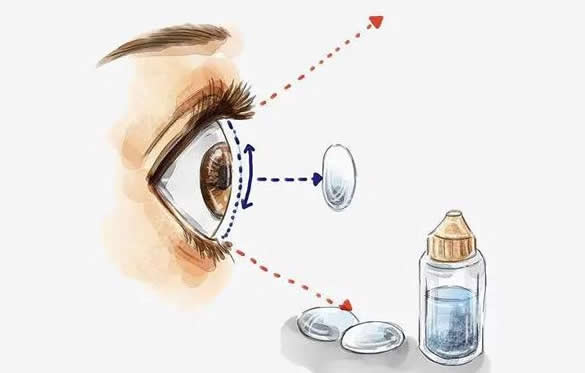 午睡一小时要不要取隐形眼睛