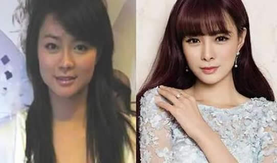 沈梦辰原来的样子 沈梦辰原来样子黑吗 沈梦辰原来的样子 沈梦辰原来样子黑吗