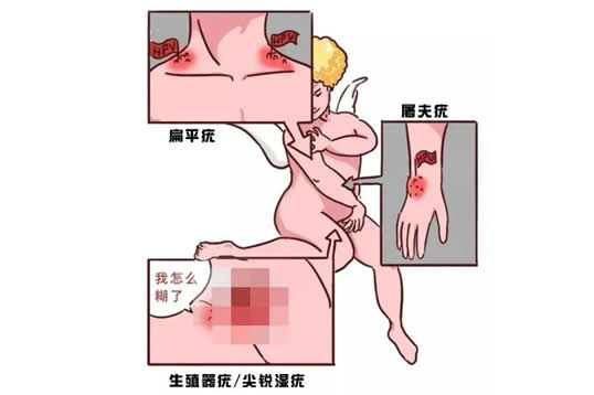 四价和九价的区别,哪一个比较好(女生打九价什么意思) 四价和九价的区别,哪一个比较好(女生打九价什么意思)